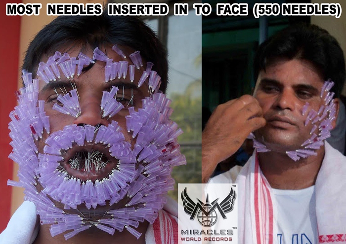 MOST NEEDLES INSERTED IN TO FACE (550 NEEDLES)  http://www.miraclesworldrecords.com/Gallery/Details/185 